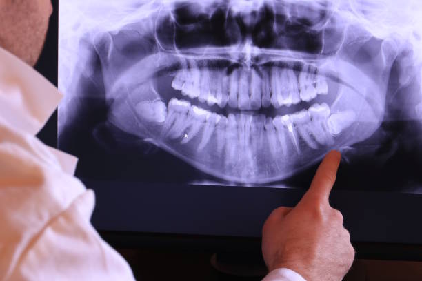 Best Emergency Cosmetic Dentistry (e.g., broken veneers) in Bridgeport, NE