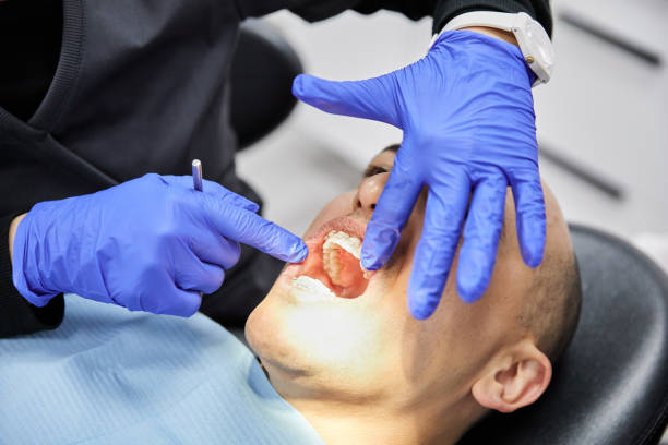 Best Emergency Treatment for Oral Infections in Bridgeport, NE